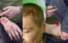 26 смертей новобранців 425 окремого штурмового полку “Скеля” - видання “Бабель”