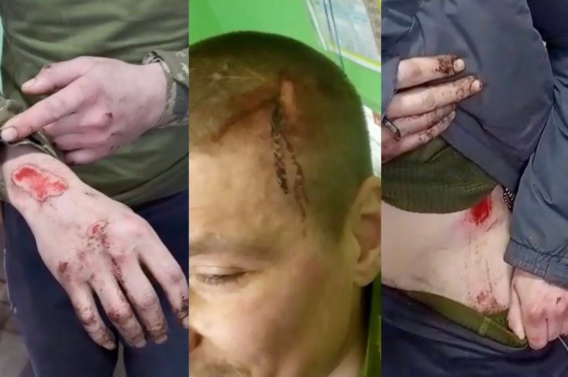 26 смертей новобранців 425 окремого штурмового полку “Скеля” - видання “Бабель”